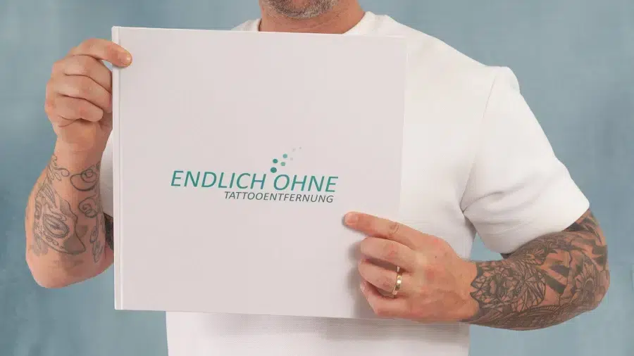 ENDLICH OHNE Tattooentfernung PARTNER